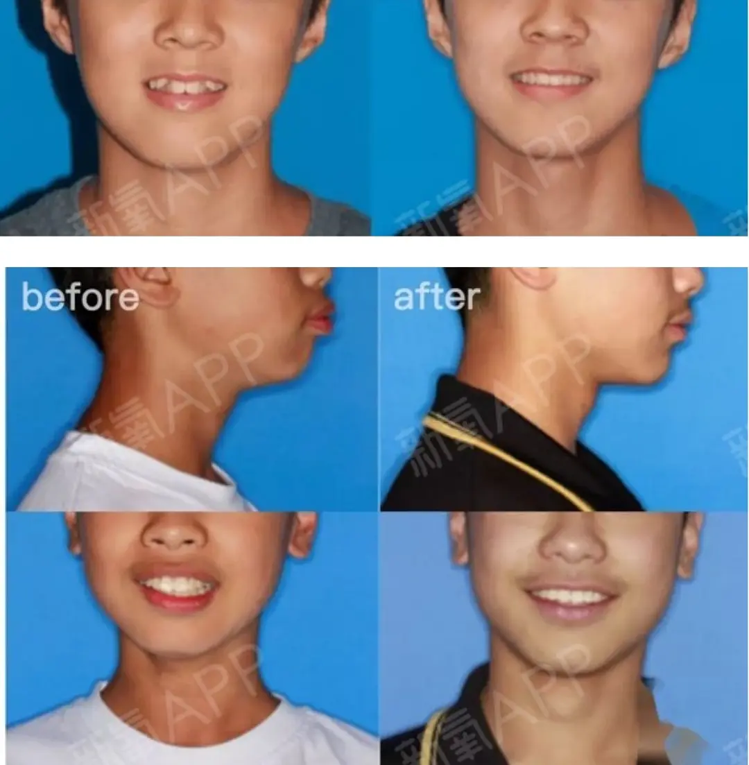 健身明星男塑型图片_健身男星_男明星健身塑型